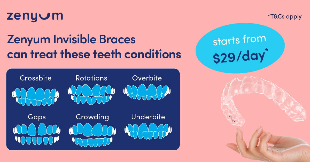 Does Zenyum Invisible Braces really work? Let these before and after photos  of a real customer speak for themselves! This patient had p